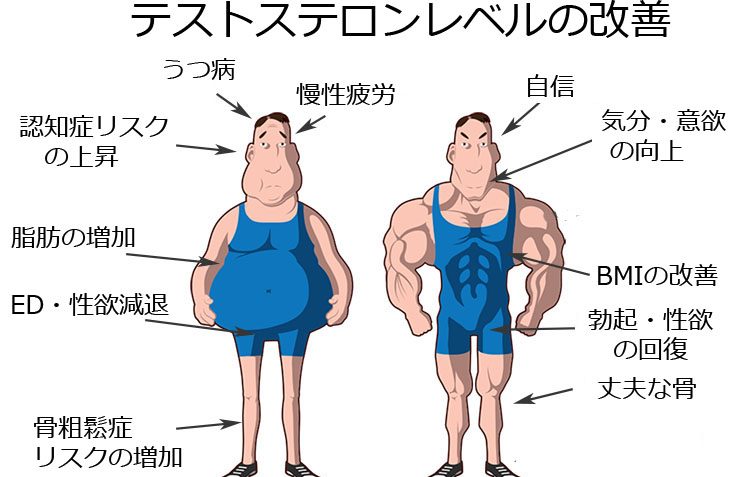 テストステロン レベル 改善 うつ病 認知症 ED 性欲 骨粗鬆症 慢性疲労