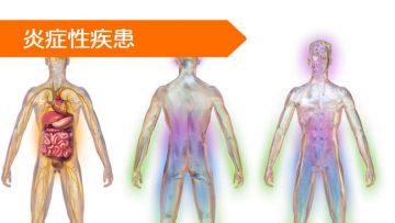 デキサメタゾン メチルプレドニゾロン
