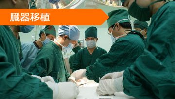 タクロリムス シロリムス