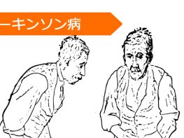 アマンタジン