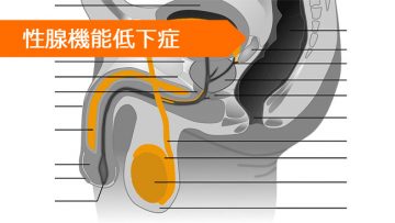 テストステロン