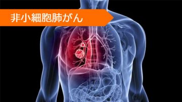 ゲフィチニブ ペメトレキセド エルロチニブ