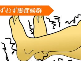 ロピニロール プラミペキソール