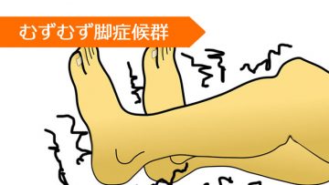 ロピニロール プラミペキソール