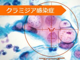 アジスロマイシン