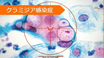アジスロマイシン