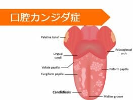 ミコナゾール