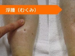 トリアムテレン