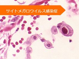 ガンシクロビル