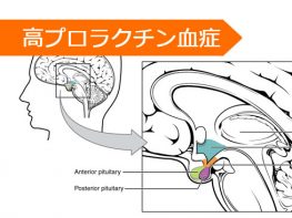 ブロモクリプチン