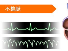 プロカインアミド