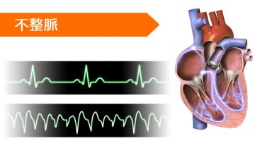 プロカインアミド